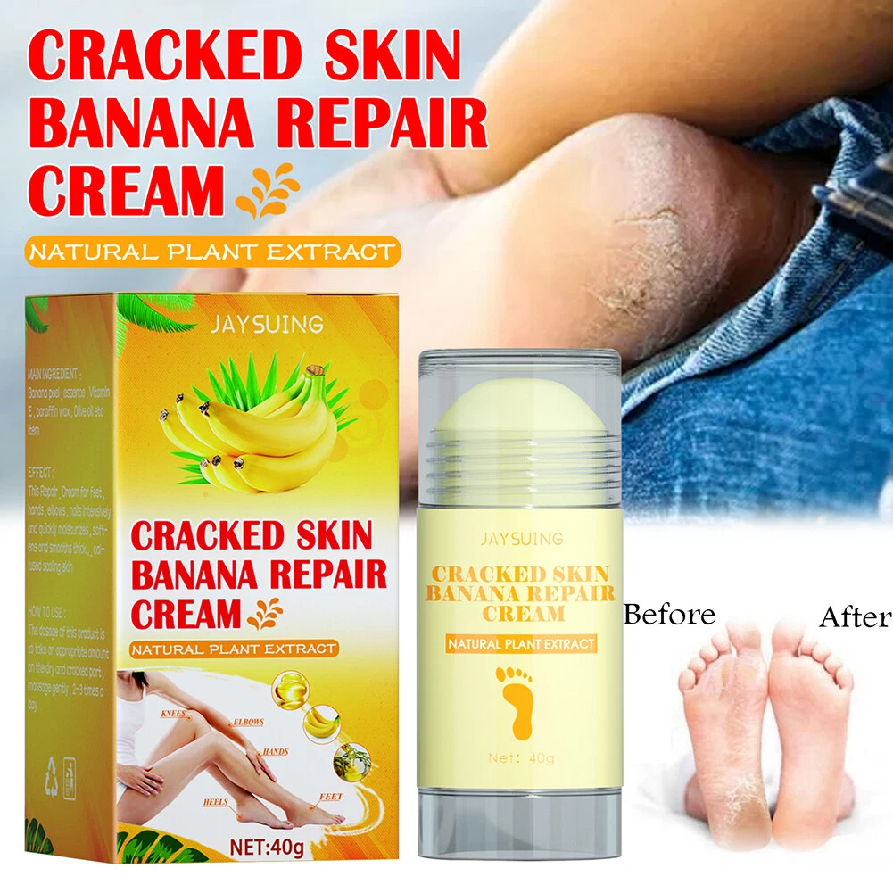 Tatvik Crack Heal Cream Camphor, Lavender & Coconut Oil