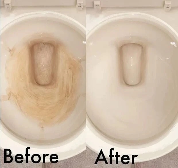 Limpador magnético para vaso sanitário/tanque - Pacote com 2 - Produtos químicos grátis + frete grátis - Imagem 2 de 4