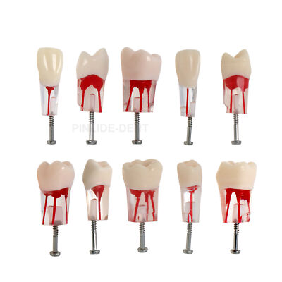 10PCS Kilgore Nissin Type Dental Endo Root canal Practise Typodont Teeth Model