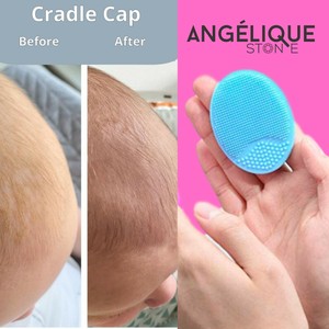 cradle cap brush