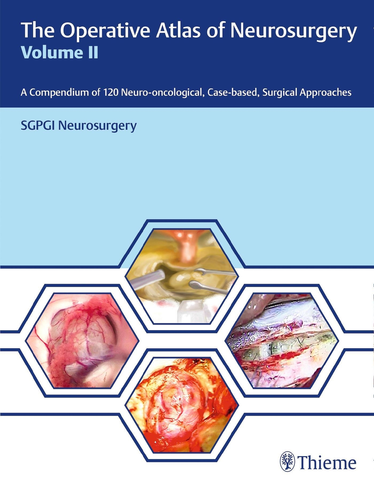 Thumbnail - The Operative Atlas Of Neurosurgery, Vol Ii Sgpgi Neurosurgery Buch