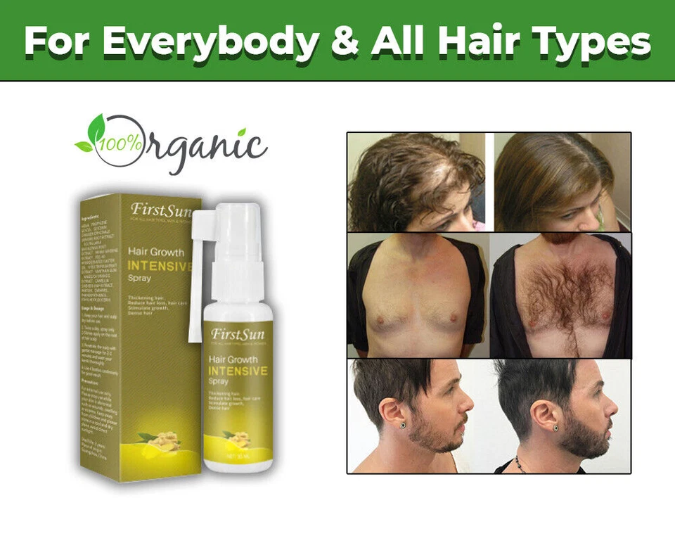 NEW FAST HAIR GROWTH OIL LOSS TREATMENT SPRAY NATURAL SAFE POWERFUL BEARD BODY - image 2 of 4