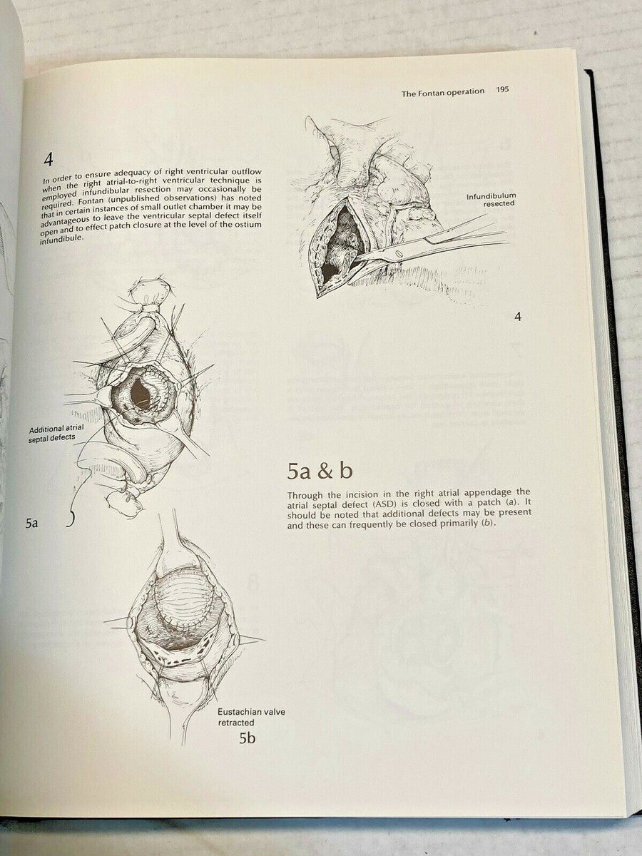 Rob & Smith's Operative Surgery Thoracic & Cardiac Surgery 2