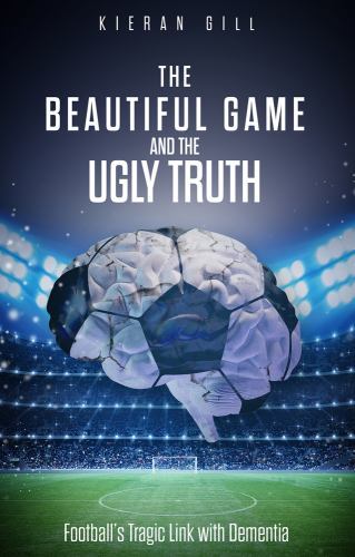 The Beautiful Game and the Ugly Truth: Football's Tragic Link with Dementia - Image 2