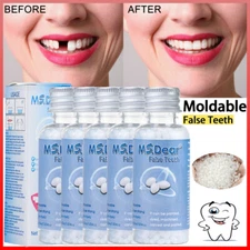 Tooth Repair Beads Granules Temporary Tooth Glue Reusable Moldable False Teeth