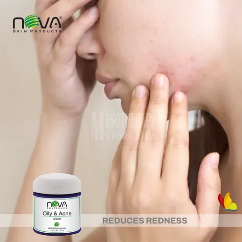 Crema grassa e acne di Nova Skin - Foto 5 di 11