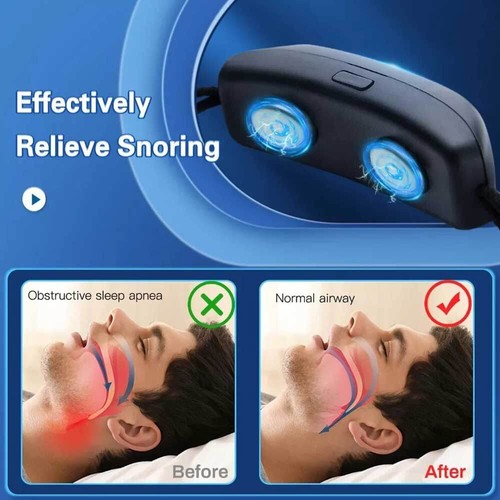 Smart Anti-snoring Device - Rechargeable Vibrating Pulse Snore Stopper Set - Picture 11 of 16