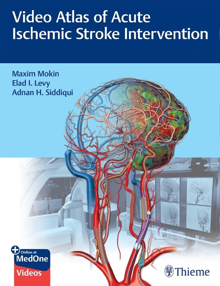 Thumbnail - Video Atlas Of Acute Ischemic Stroke Intervention | Maxim Mokin (u.