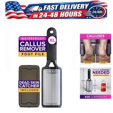 NYK1 MegaFile Foot File Callus Remover with Catcher XL Stainless Steel