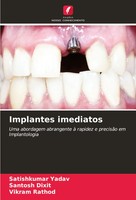 Implantes Imediatos Satishkumar Yadav (U. A.) Taschenbuch Portugiesisch 2024