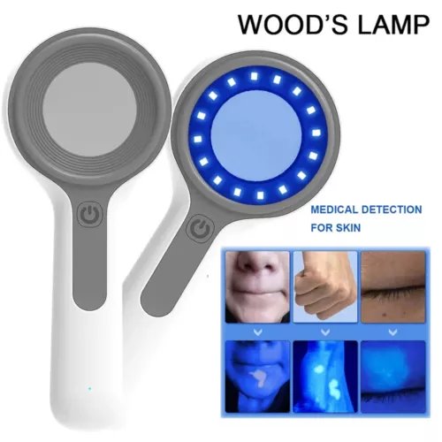 Wood's Lamp Dermatology Medical LED Woods Lamp Skin Analyzer For Vitiligo Skin - Picture 2 of 9