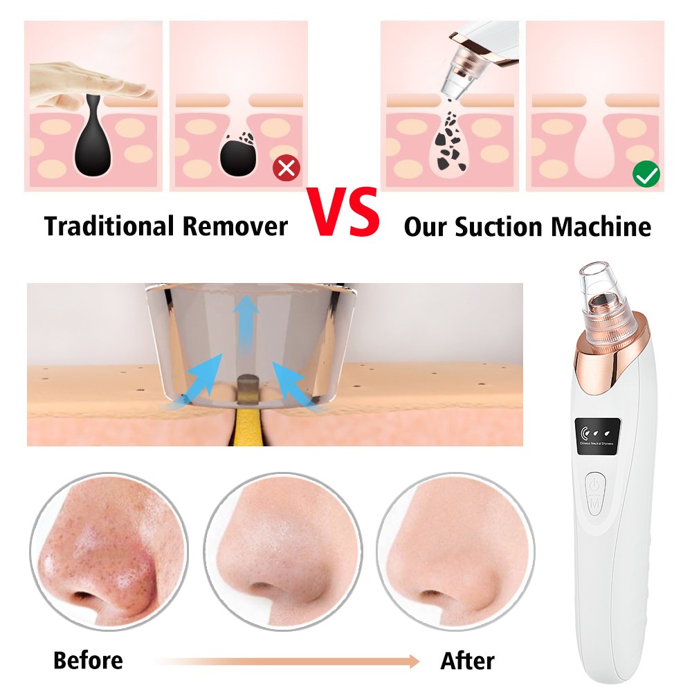 Electric Blackhead Remover Vacuum Facial Pore Cleanser Acne Skin Face Cleanser