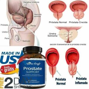 Prostatitis reuma