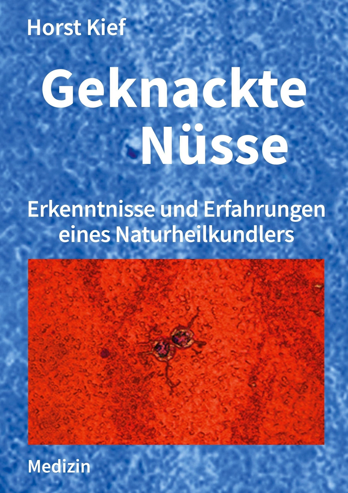 Thumbnail - Geknackte Nüsse Erkenntnisse Und Erfahrungen Eines Naturheilkundlers