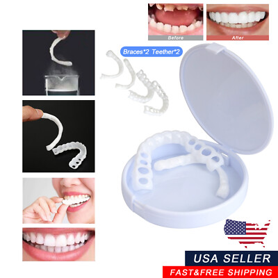 1x Smile Snap On Upper＆Bottom Set False Teeth Denture Veneers Dental Tooth Cover