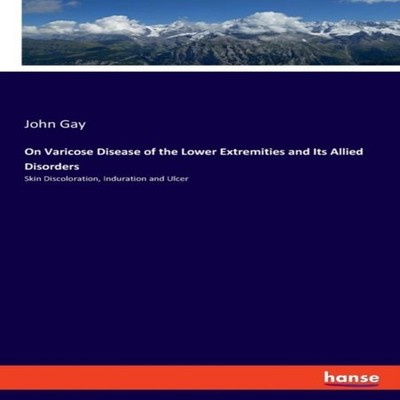 On Varicose Disease of the Lower Extremities and Its Allied Disor