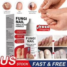 Fungi-Nail Anti-Fungal Liquid Solution Kills Fungus That Can Lead To Nail
