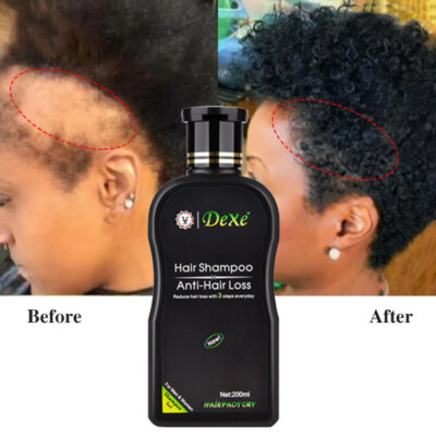 DEXE Fast Hair Growth Shampoo Anti Hair Loss Hair Thickening For Women&Men 200ml