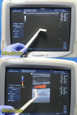 GE P/N 2664882 i12L Linear Array Intraoperative Ultrasound Transducer ~ 21048