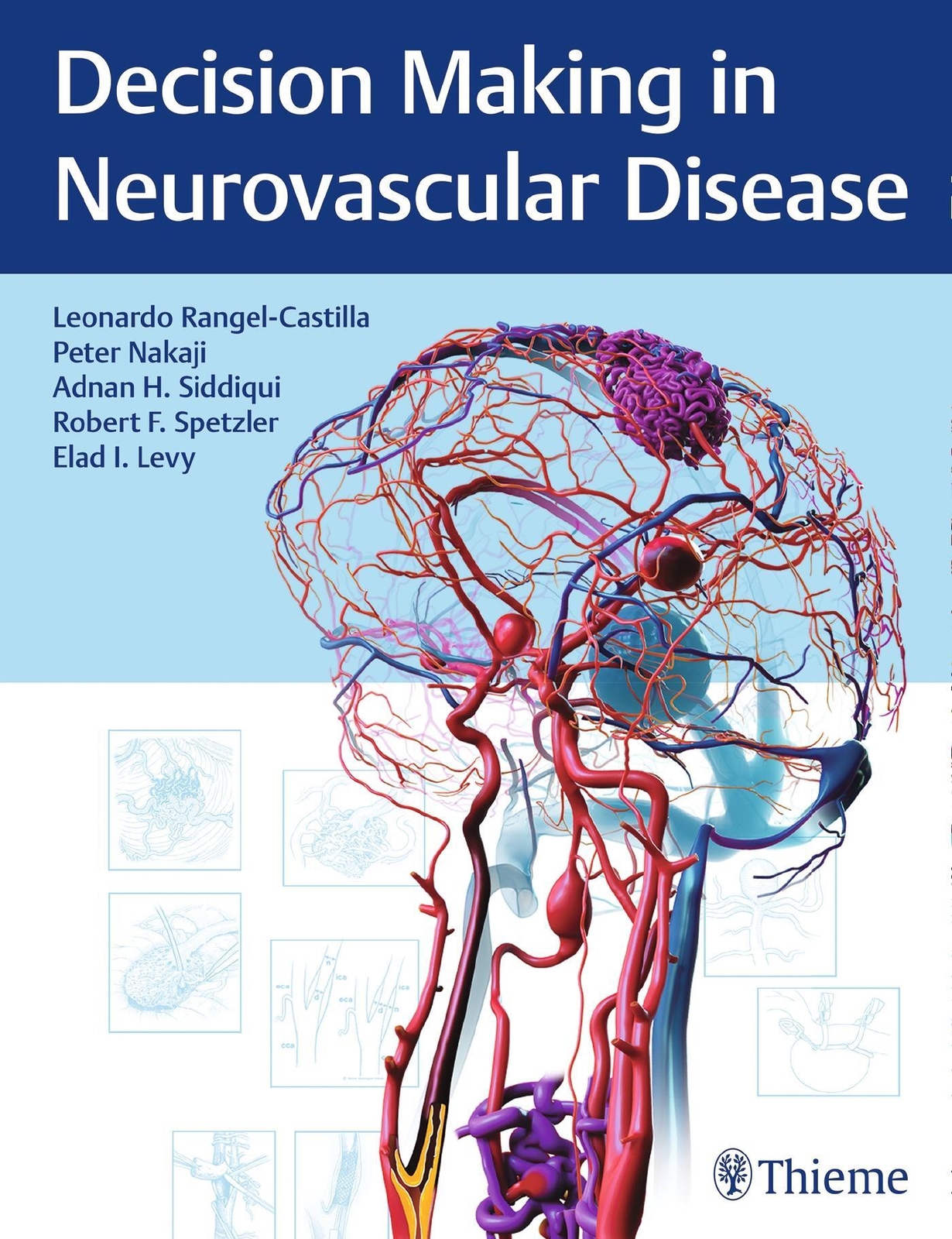 Decision Making In Neurovascular Disease | Leonardo Rangel-castilla