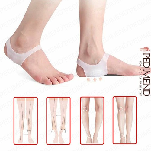 PEDIMEND™ Leg correction Cushion Pad Foot Arch Support Relief Gel Sleeve 1PAIRUK - 第 1/9 張圖片