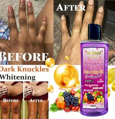 Dr Meinaier Whitening Essential Oil Face & Body Removing Dark Spots   