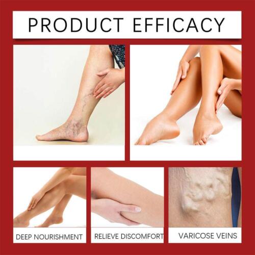 Horse Chestnut Varicose Veins Lymph Massage Cr eam 100g Eliminate - Edema Z8W0- - Picture 8 of 10
