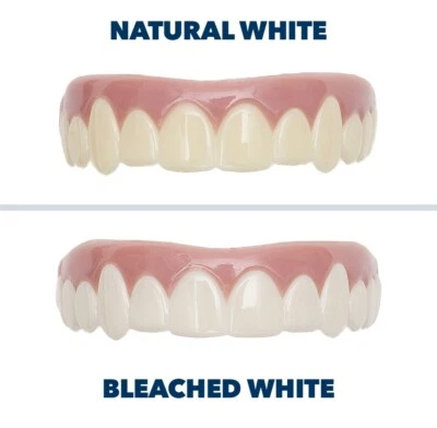 Original Imako Kosmetik Zahnabdeckung, Instant Hollywood Smile natürlich oder gebleicht