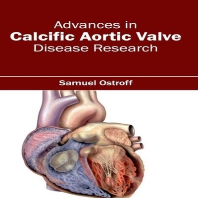 Advances in Calcific Aortic Valve Disease Research ML Books Inter