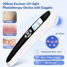 Handheld 308nm UVB Light Therapy Device 6 Diodes 20mW/cm2 for Skin Wellness
