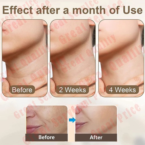 LED Microcurrent Facial Skin Tightening Lifting Device Face Neck Beauty Machine - Picture 14 of 16