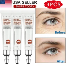 3x Cayman Eye Cream Instant Eye bags Dark Circles Removal Anti Puffiness Wrinkle