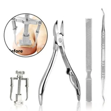 Ingrown Toenails Manicure Pedicure Foot Nail Care Tools Fixer Recover Correction