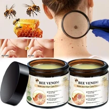 2026 Bee Venom Skin Tag Removal Treatment Cream Body Care Mole Corn Wart Remover