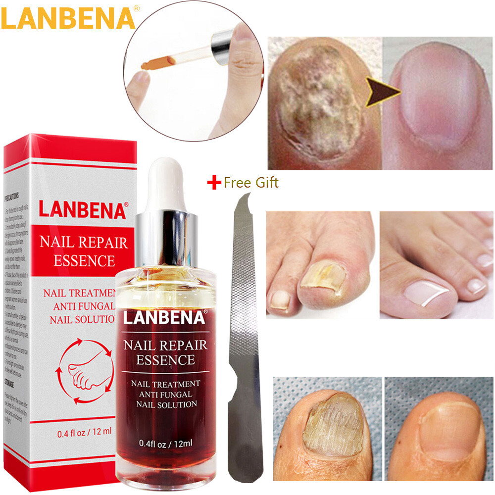lanbena nail repair