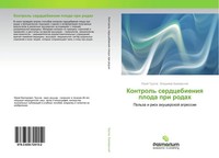 Jurij Trusow (U. A.) | Kontrol' Serdcebieniq Ploda Pri Rodah | Taschenbuch