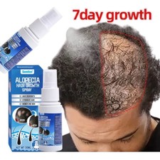 Hair Growth Serum Spray Ginger Anti Hair Loss Scalp Treatment Thicker Hair