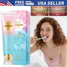 Niacinamide Whitening Toothpaste Niacinamide Dazzling Whitening Toothpastes