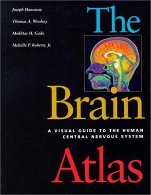 The Brain Atlas: A Visual - Hardcover, by Hanaway Joseph; Woolsey - Very Good