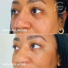 Skin Care Eye Balm Rose Glow - Dark Circle Treatment, Instantly Hydrate and B...