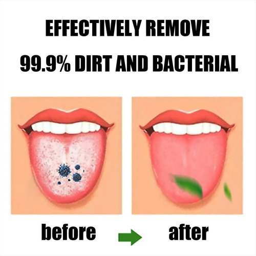 Tongue Brush, Tongue Scraper, Tongue Cleaner Helps Fight Bad Breath, 3 Tongue Sc - Picture 8 of 12