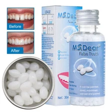 Teeth Glue For Loose Teeth Temporary Tooth Repair Beads Loose Tooth Repair fine