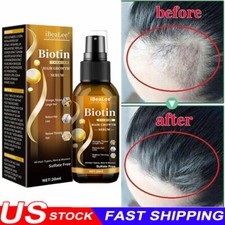 Biotin Hair Growth Spray Anti Hair Loss Fast Regrowth Scalp Treatment Serum US