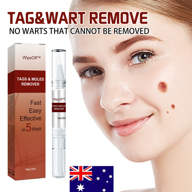 Common and Plantar Moles-Off Wartsoff Remover WipeOff Tags & Moles Remover Common and Plantar Moles-Off Wartsoff Remover WipeOff Tags & Moles Remover