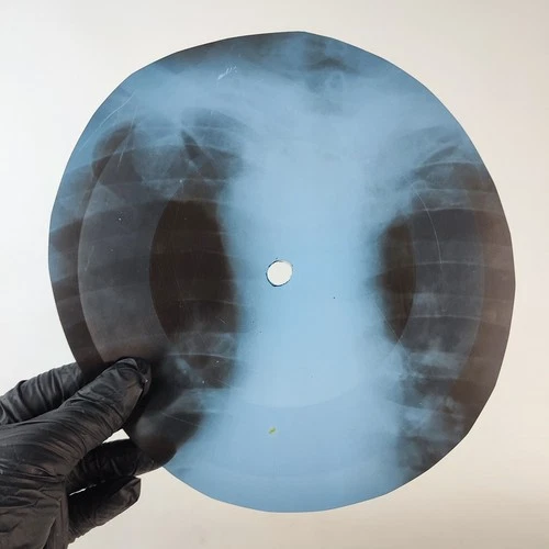 LED ZEPPELIN WHAOLLA LOTTA LOVE X-Ray USSR Record Roentgen Bone Ribs Music Vinyl