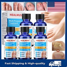1-5PCS Antibacterial Fungal Nail Treatment Nail Repair Essential Oil Serum 30g