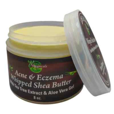 Acne & Eczema Whipped Shea Butter With Tea Tree Extract & Aloe Vera Gel ﻿Acne