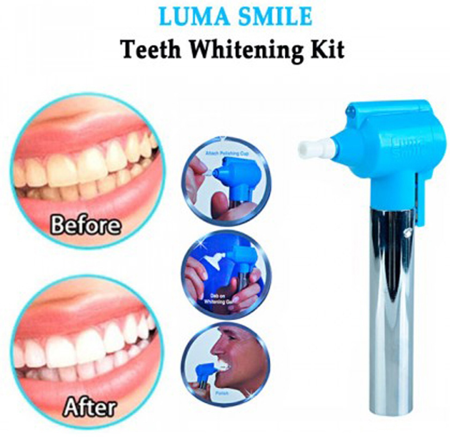 Teeth Whitening & Polish Machine With 5 Polishing Cups Stains Luma