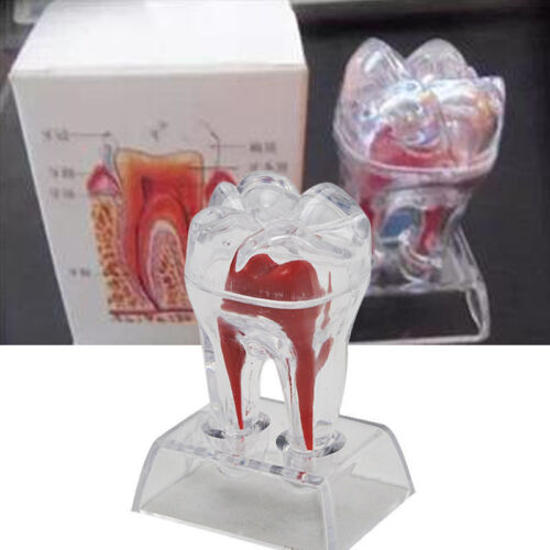 Dental Supplies Dentistry Crystal Base Hard Plastic Teeth Tooth Molar Model Hot - Picture 1 of 12
