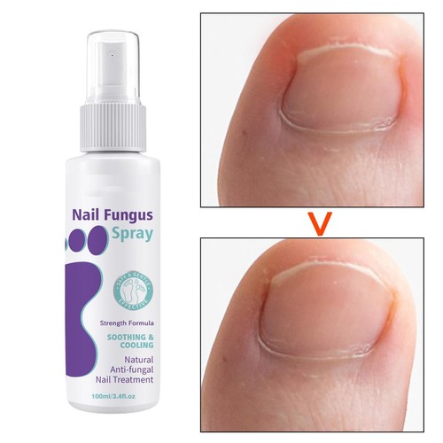 Spray réparateur pour ongles et mains 100 ml pour ongles décolorés et - Picture 6 of 7
